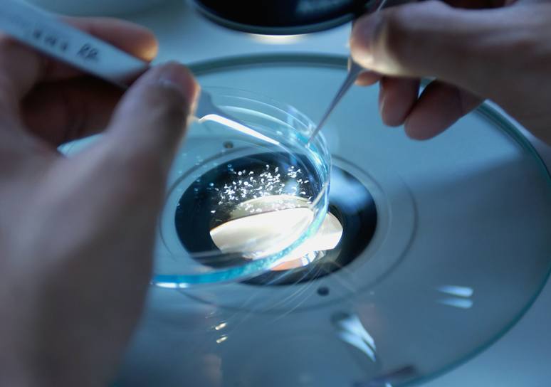 Two hands use tweezers to handle small specimens in a glass petri dish lit from below on a microscope stage.